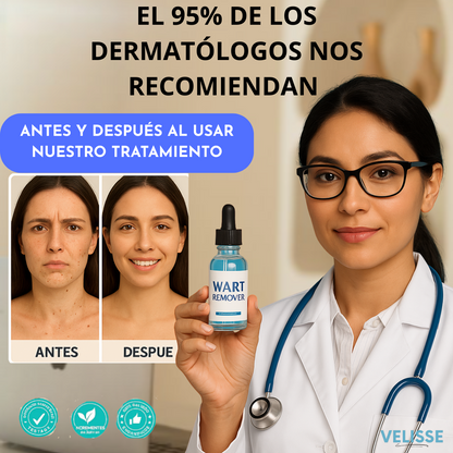 Wart Remover® : Adiós a lo que sobra, resalta tu belleza