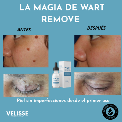 Wart Remover® : Adiós a lo que sobra, resalta tu belleza