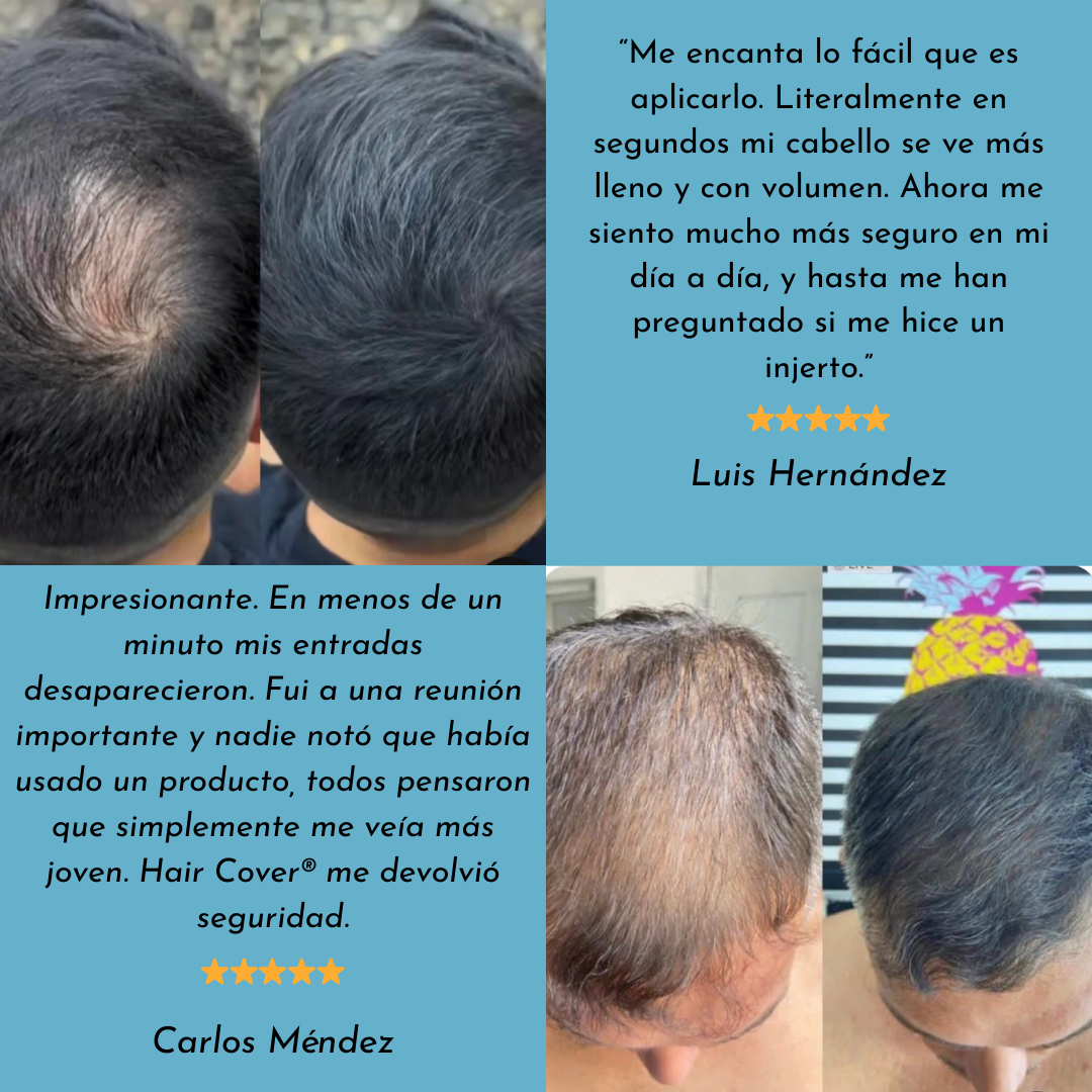 Hair Cover® – Más que cubrir, devolver confianza.